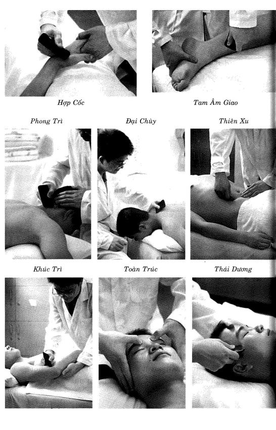 Cạo gió viêm mí mắt