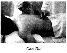Cạo gió viêm mí mắt