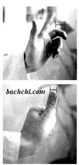 Cách xác định các huyệt cạo gió